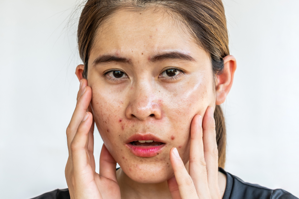 Young skin, nails and hair